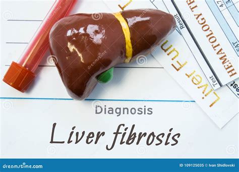 Liver Fibrosis Diagnosis. Sheet of Paper or Book with Inscription Liver Fibrosis Lie Next To ...