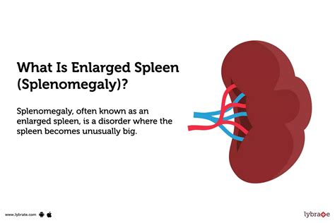 Enlarged Spleen (Splenomegaly): Symptoms, Causes Treatment, 44% OFF