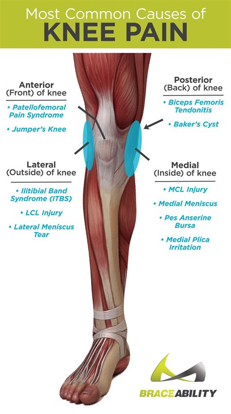 The Most Common Causes of Anterior, Posterior, Medial, and Lateral Knee Pain Muscle Anatomy ...