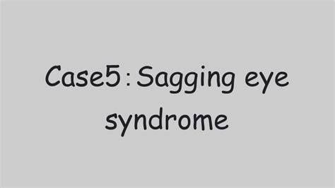 Case 5–1: Is it really age? Sagging Eye Syndrome | by neuro-opthal | Medium