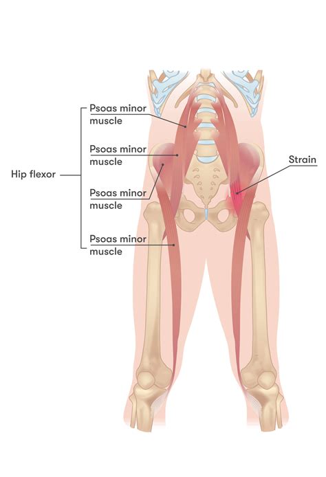 Hip Pain After Running: Causes, Pain Relief & Prevention