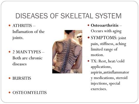 Skeletal System Diseases