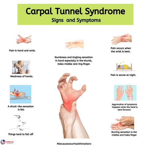 Carpal Tunnel Syndrome: Signs & Symptoms