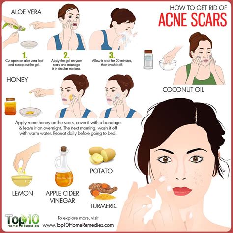 How to Get Rid of Acne Scars | Top 10 Home Remedies