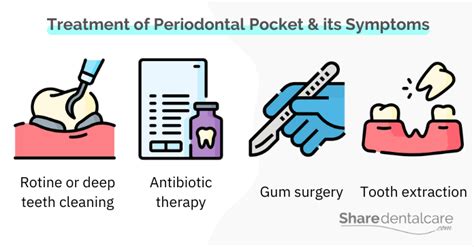 Periodontal Pocket Symptoms - Share Dental Care