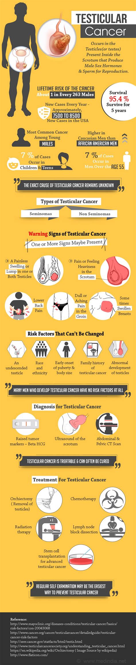 Testicular Cancer Lump - Testicular Cancer Net Health Book - The most common symptom of ...