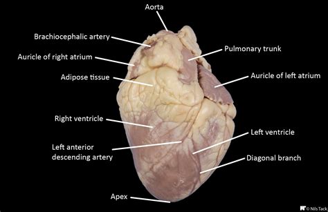 Sheep heart surface anatomy | Heart anatomy, Heart diagram, Anatomy and ...