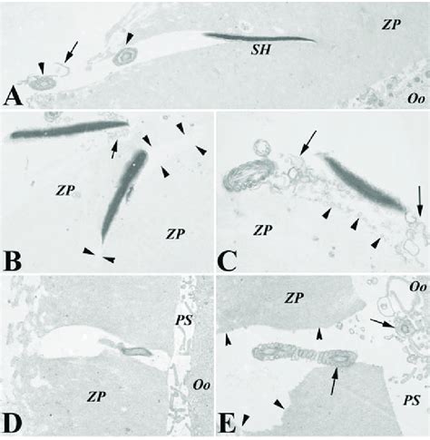 Transmission electron microscopy of sperm-zona pellucida interactions... | Download Scientific ...