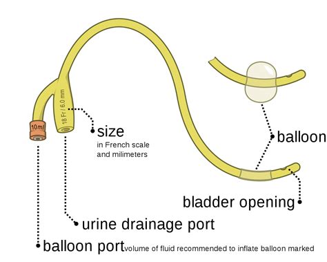 foley catheter sizing