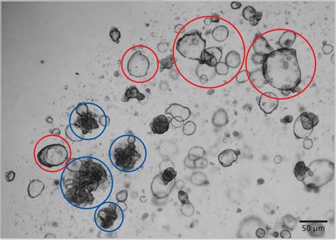 Protocol for Freezing Intestinal Organoids | STEMCELL Technologies