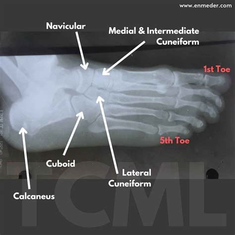 Labeled Tarsals