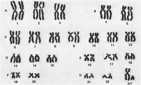 Medical School • Human Chromosomes