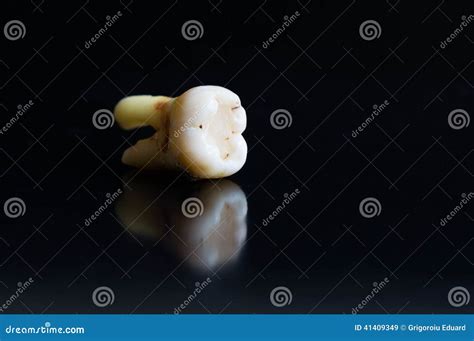 Broken Tooth After Extraction Stock Photo - Image: 41409349