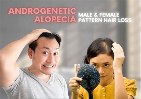 A Comprehensive Guide to Androgenic Alopecia