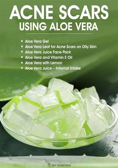 How to Clear Acne Scars using Aloe Vera