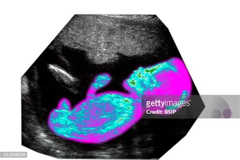 57 22 Weeks Pregnant Ultrasound Stock Photos, High-Res Pictures, and Images - Getty Images