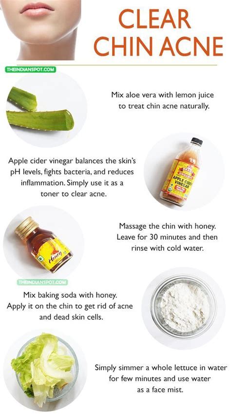 How To Clear Up Hormonal Chin Acne - shearlingwomenbestquality