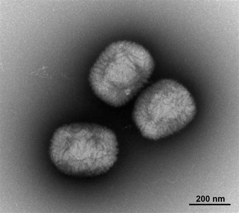 Negative Staining Electron Microscopy - 2016 - Wiley Analytical Science