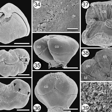 Tupidanthus calyptratus, androecium development. 40-42 Variation in... | Download Scientific Diagram