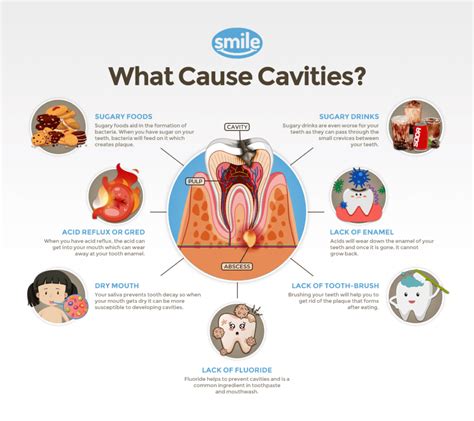 10 Tips That Will Help Prevent Cavities – Kids Dental Guard