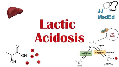 How Lactic Acid Is Removed