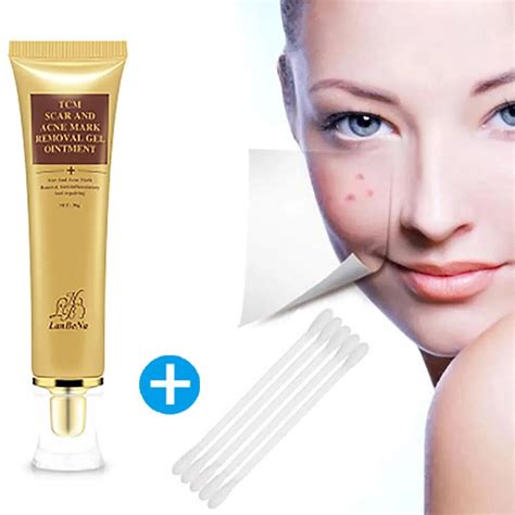 Brand New Acne Scar Removal Cream Skin Repair Face Cream Acne Spot Treatment 30ml Moisturizer ...