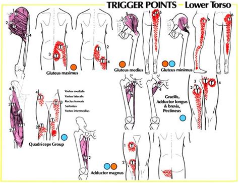 Pin on Trigger points