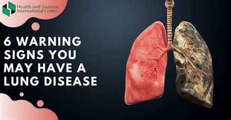 6 symptoms indicating lung problems - HTI CENTERS | Medical Tourism Center