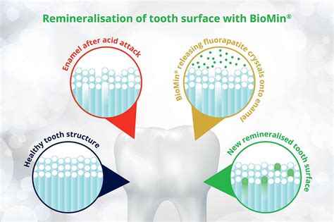 Biomin F remineralises enamel more effectively - Dentistry