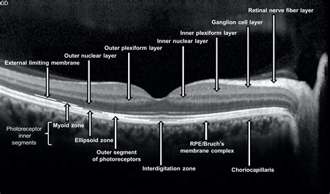 Oct Retinal Layers Diagram