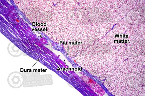 Mammal. Spinal cord. Transverse section. 125X - Spinal cord - Mammals ...