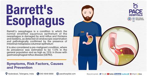 Barrett's esophagus – Symptoms, Causes, Types and Complications