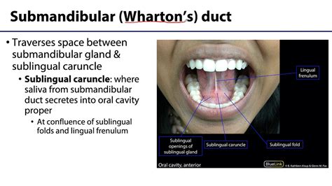 Sublingual Caruncle Swelling