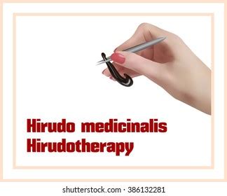 Hirudo Medicinalis Hirudotherapy Treatment Leeches Stock Vector ...