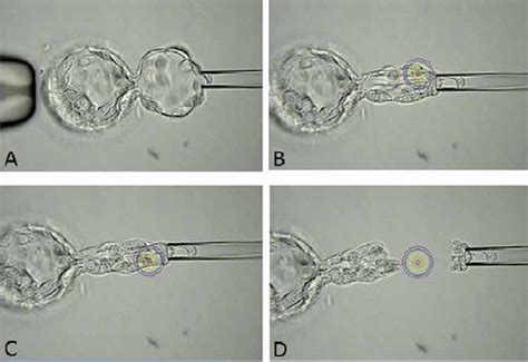 Procedures for two-step blastocyst biopsy. A blastocyst with some ...