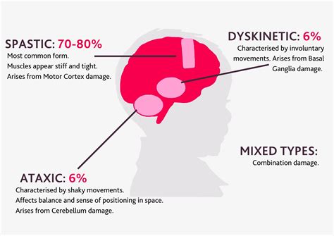 Different types of cerebral palsy | Cerebral Palsy Cymru