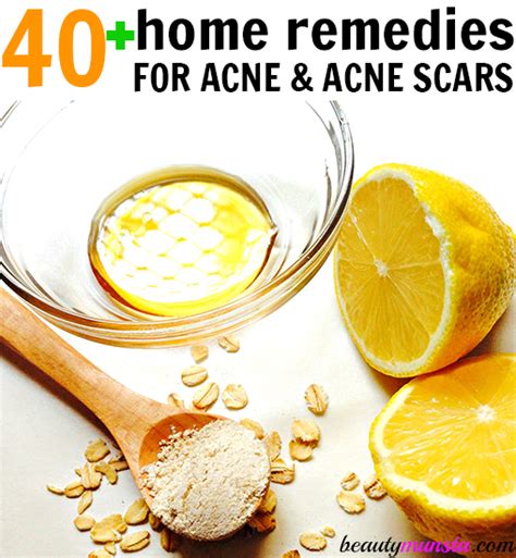 40 + DIY Acne Remedies That Work! (Including Pimples, Acne Scars ...