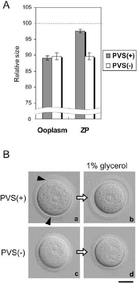 Figure 2 from The perivitelline space-forming capacity of mouse oocytes is associated with ...