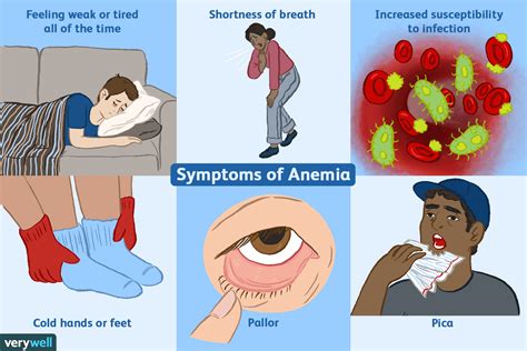 Blood Cancer and Anemia