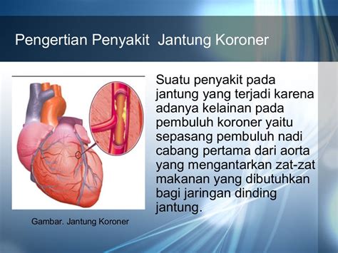 Penyakit jantung koroner