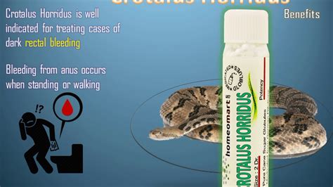 Crotalus Horridus - Homeopathic Medicine for Glossitis, Paralysis & Bleeding Disorders | #shorts ...