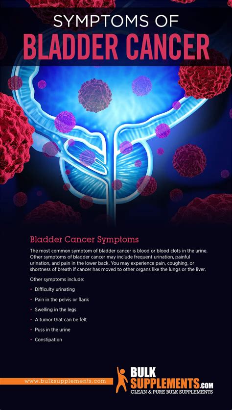 Tablo | Read 'Bladder Cancer: Symptoms, Causes & Treatment' by