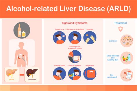 Vector illustration.infographic Signs and Symptoms of Alcoholic Fatty Liver Disease and ...