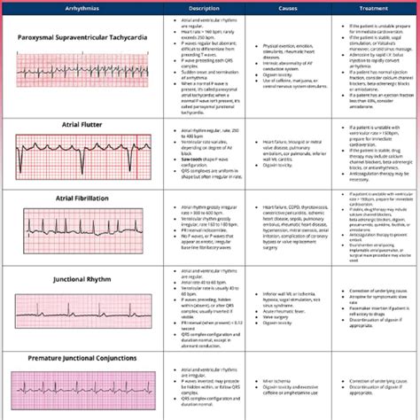 Ecg Interpretation