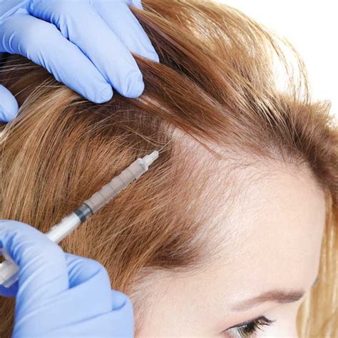 Treatment for Alopecia at Philadelphia Homeopathic Clinic by Dr. Tsan