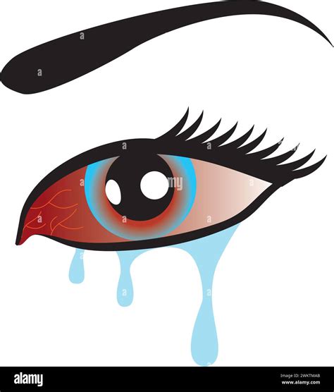 Eye flu infection icon, red eyes disease, Redness of the Eye, Conjunctivitis Stock Vector Image ...