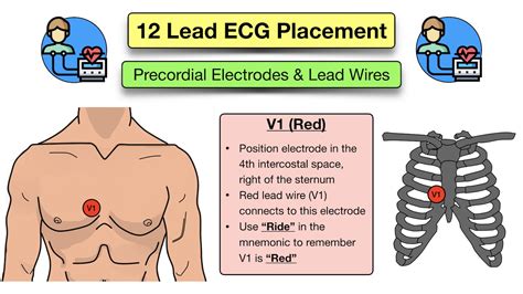 12 Lead ECG Placement: Diagram And Mnemonic For Limb And, 41% OFF