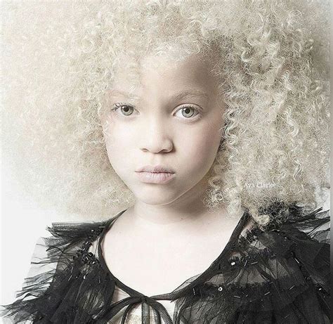 121 best Albino images on Pinterest | Albino, Beautiful people and ...