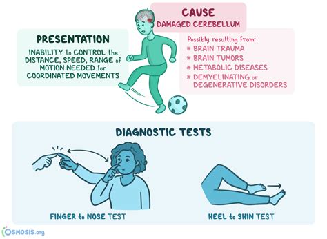 Why is Dysmetria lost Spatial Awareness? - Scot MS