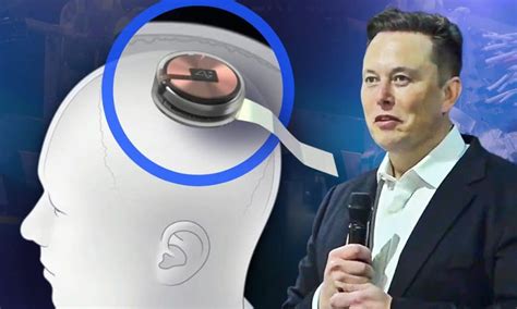 Elon Musk’s Neuralink brain chip demo explained – Cyber Tech TV